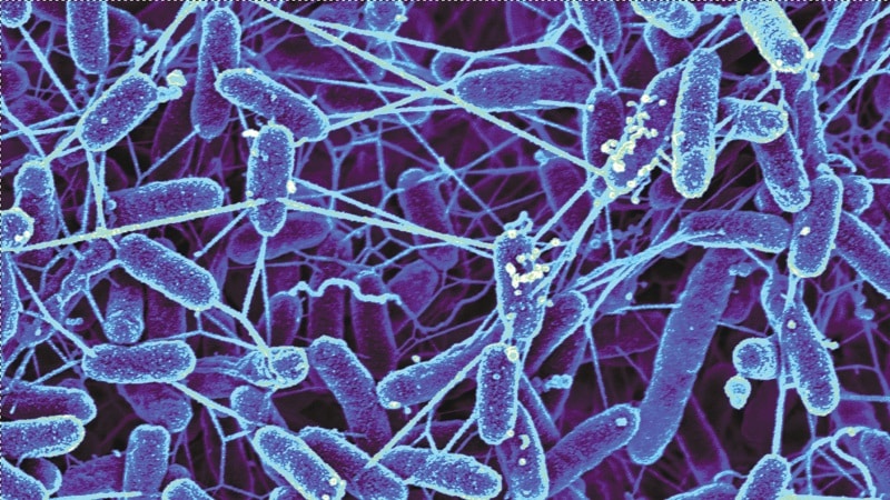 Ukoliko postoji u Sunčevu sustavu, vanzemaljski život nije odmakao dalje od mikroskopske razine (Credit: popsci.com)